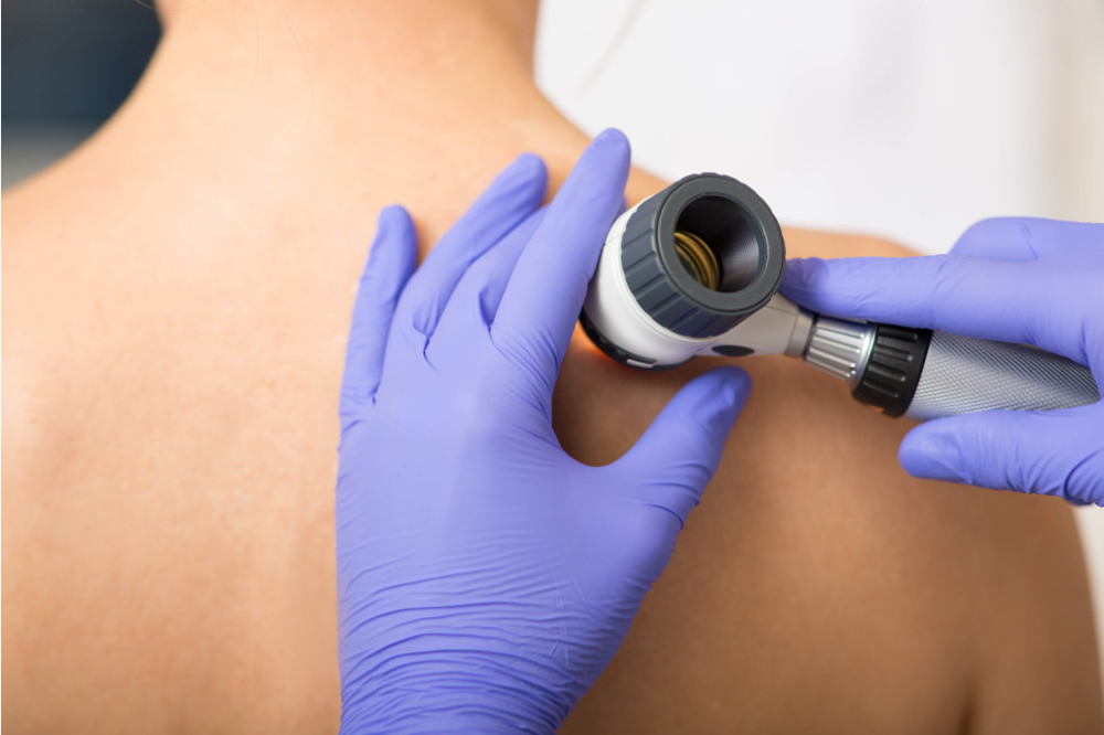 Salute, i consigli sulla pelle in vista della bella stagione