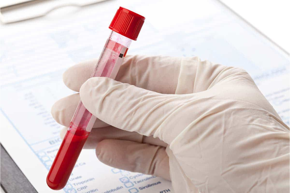 Il nuovo progetto che porta gli esami del sangue a prezzi agevolati 