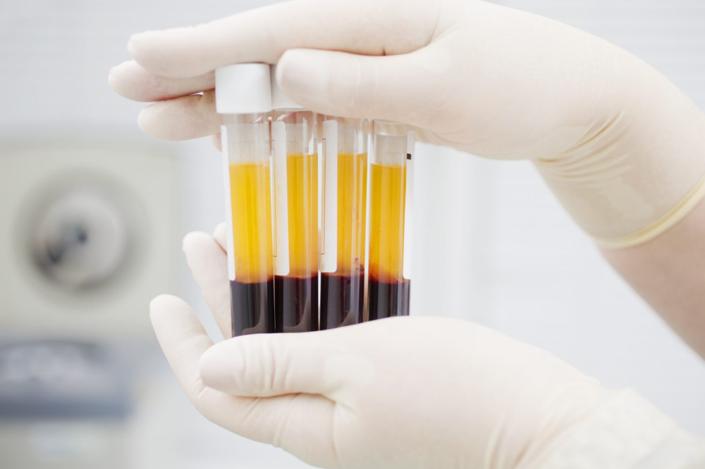 Vuoi donare il plasma? Ecco come puoi farlo al centro trasfusionale di Empoli