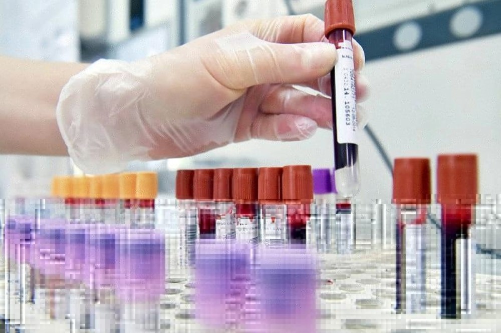 Plasmaderivati, Toscana capofila per un uso più appropriato dei farmaci